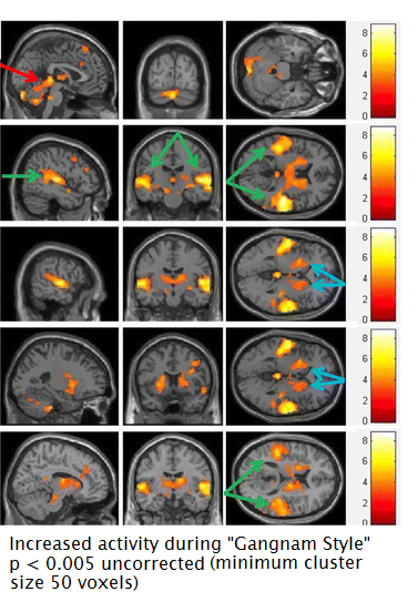 Op, Op, Op. The Neuroscience of Gangnam Style?