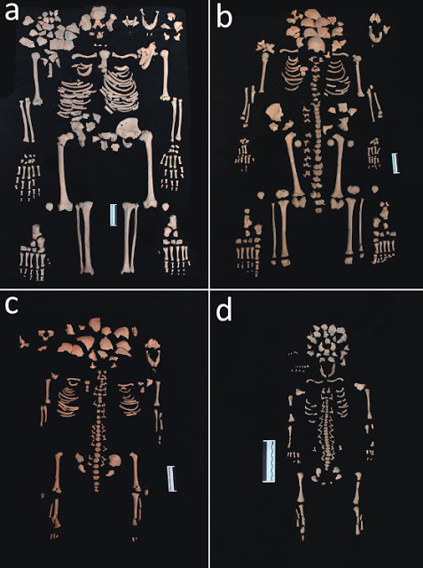 Four skeletons found in a single medieval Italian grave tell a grim story of life during the Black Death. A pregnant woman in her 30s (a) was buried with a 12-year-old (b) and a 3-year-old (c); after death, her near-term fetus (d) was expelled in an event researchers call postmortem fetal extrusion. (Credit Cesana et al 2017, http://doi.org/10.1537/ase.161011)