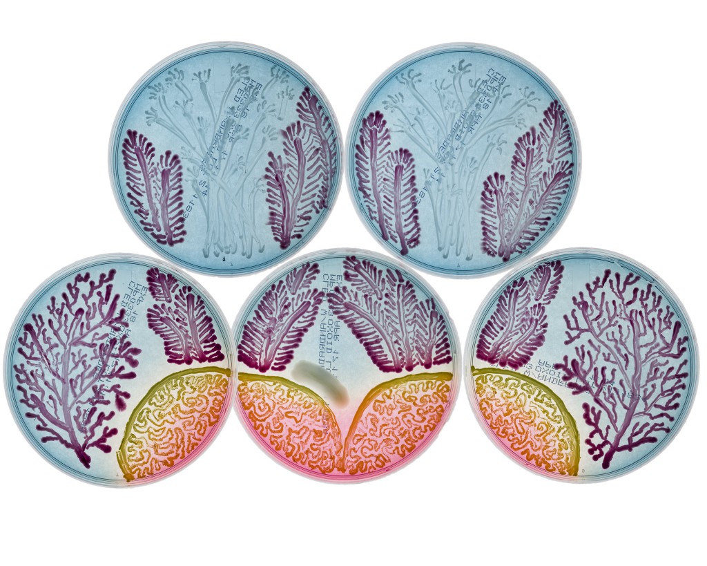 Agar Art Contest Winners Grow Masterpieces with Microbes
