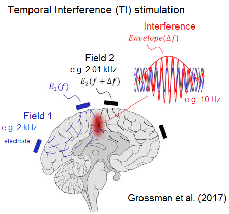 Noninvasive Deep Brain Stimulation – Has Neuroscience's Holy Grail Been Found?