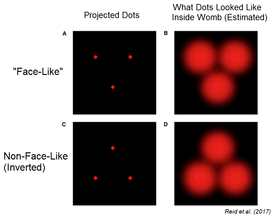 Visual Face-preference in the Human Fetus?