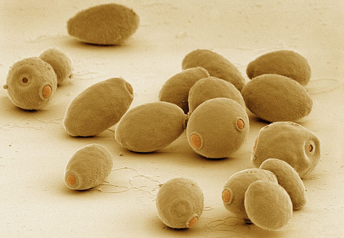 Everything Worth Knowing About … Yeast