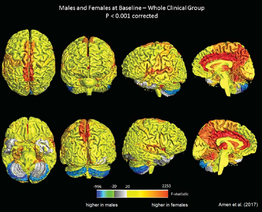 Female Brains Are More Active?