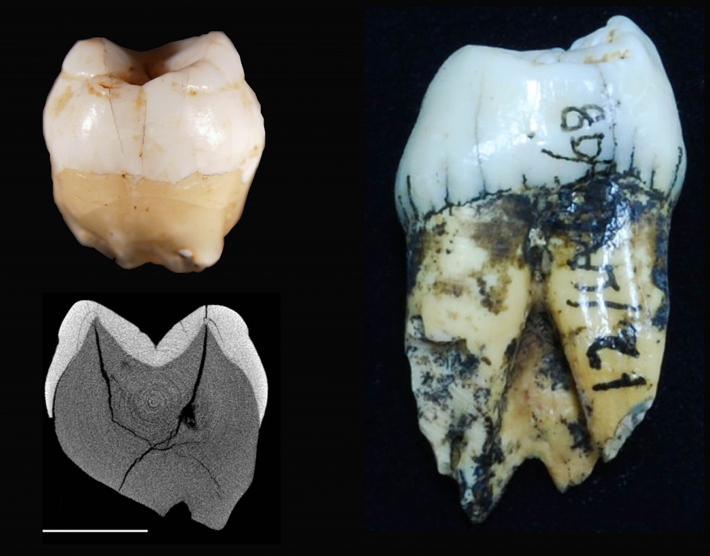 Lida Ajer modern human tooth (left top) with its corresponding scanned image (left bottom) compared to an orangutan tooth (right) Credit: Tanya Smith and Rokus Awe Due