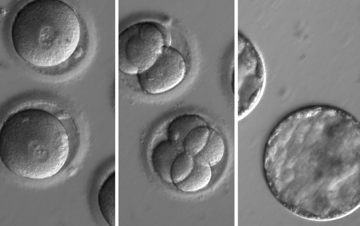 In a First, Scientists Edit Human Embryos In a US Lab
