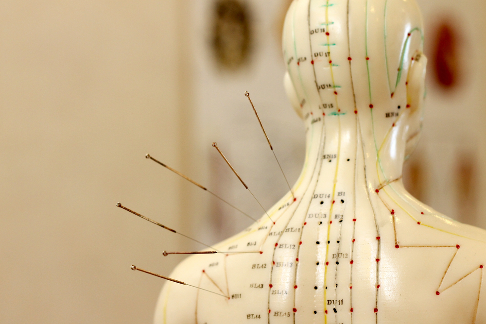 Acupuncture Works by 'Re-Wiring' the Brain, Evidence Suggests