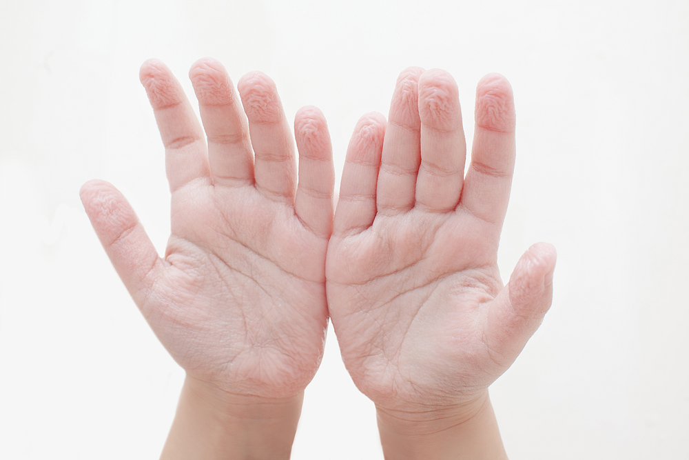 Wrinkled Fingers Might Be Your Body's Rain Treads