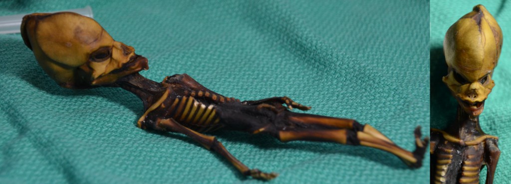 Atacama “Alien” Update: DNA Details Of Six-Inch Skeleton