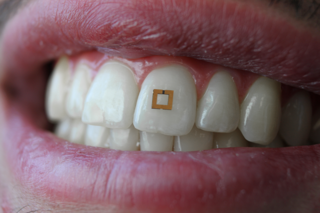 Better Diet Data Via Tooth-Mounted Sensors