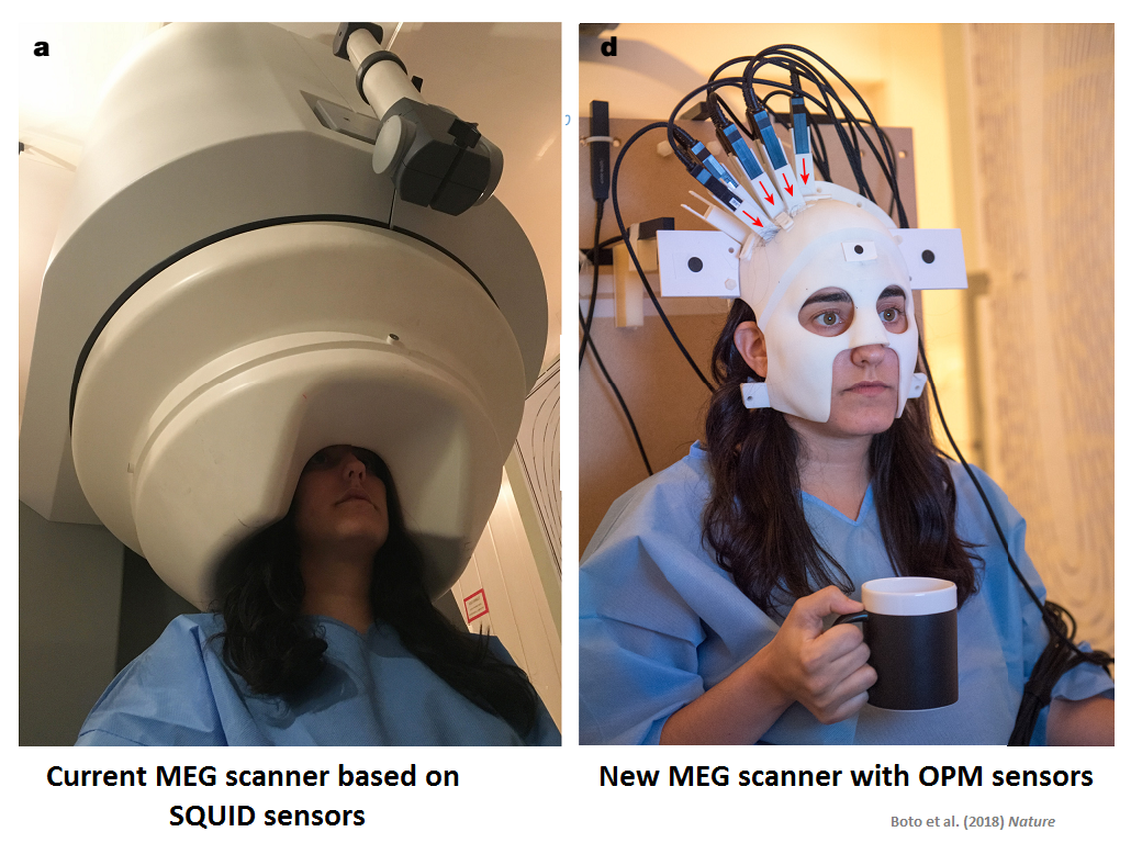 Mobile MEG: Will New Technology Change Neuroscience?