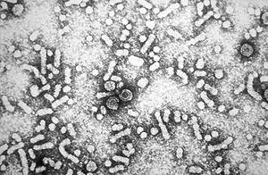 Hepatitis B virus (Credit Wikimedia Commons)
