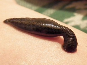 Where can leeches be found? A) Up your nose. B) In your ear. C) In your urethra. D) All of the above.