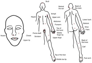 Figure 1: Sting Locations. Drawing of the human form with Xs and labels at the sting locations.