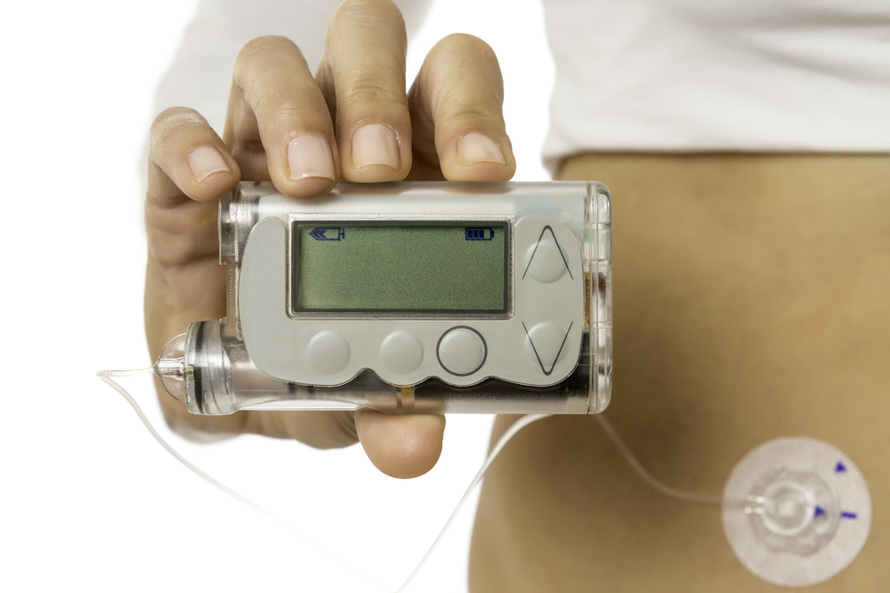 Insulin pumps are one of the newer ways to administer the drug to diabetic patients. (Credit: Click and Photo/Shutterstock)