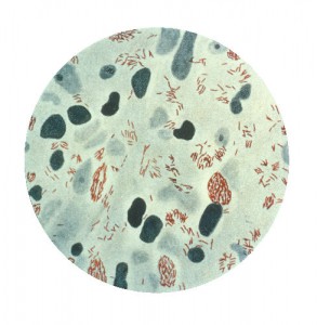 mycobacterium leprae