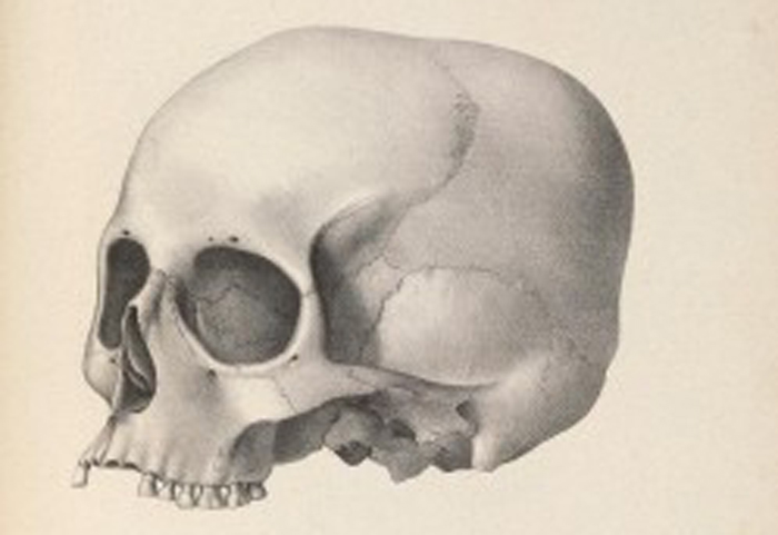 Lost Research Notes Clear Up Racial Bias Debate in Old Skull Size Study